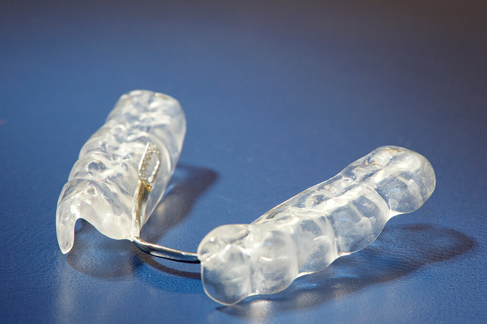 Funktionstherapie - Zahnschiene Unterkiefer transparent Funktionstherapie - Zahnschiene Unterkiefer transparent